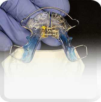aligners and braces type