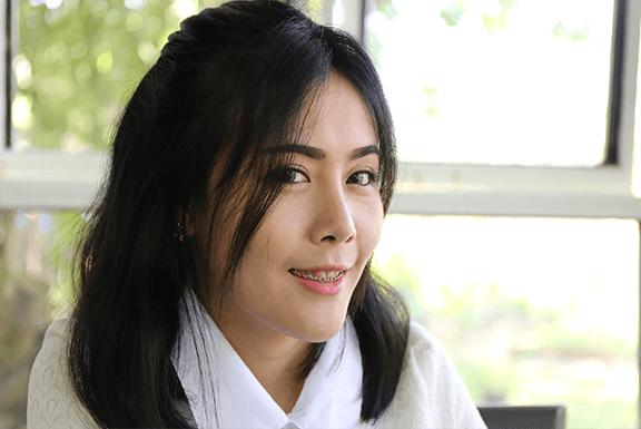 botox treatment botox treatment