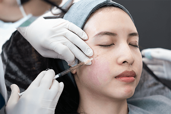 botox treatment botox treatment