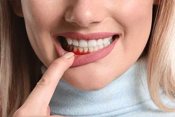 gum treatment gum treatment