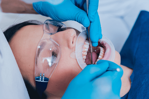 root canal treatment root canal treatment