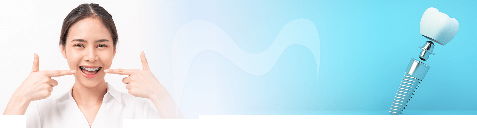 dental options  Singapore